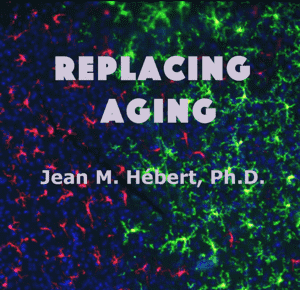 Replacing aging featured